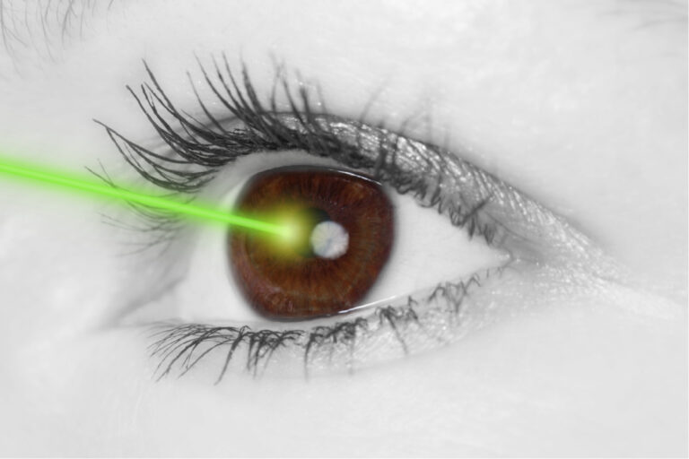 Green Laser